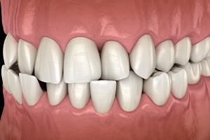 Woman smiling while relaxing in treatment chair