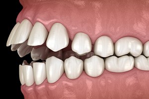 Woman smiling while relaxing in treatment chair