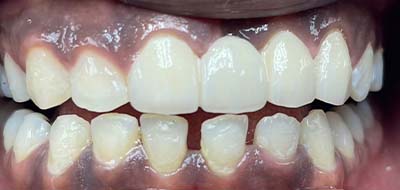 Gorgeous smile after restorative dentistry