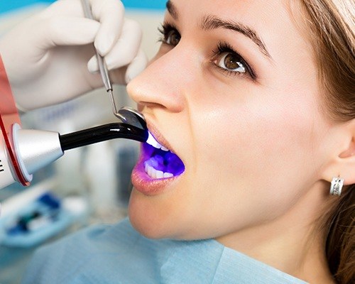 Woman receiving cosmetic dental bonding