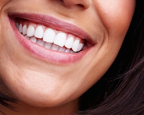 Closeup of brilliant smile after teeth whitening