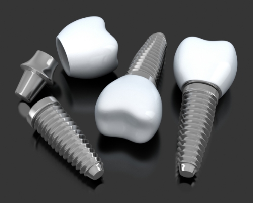 Three animated dental implant supported dental crowns