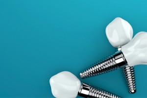 Dental implants laying against a dark blue background