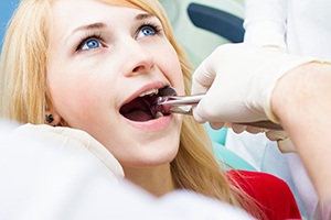 young woman getting tooth extraction from emergency dentist in Bedford