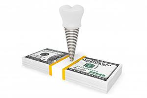 dental implant post with crown on top of a stack of cash 
