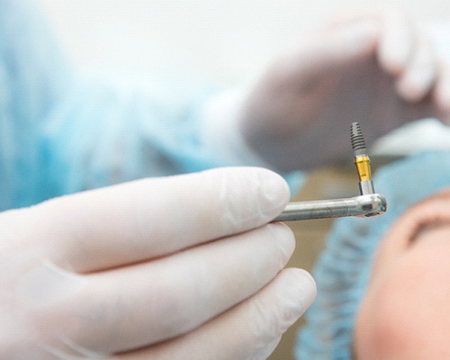 Dentist preparing to place dental implant in patient’s mouth