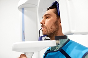 man getting a CT cone beam scan of his mouth and jaw 