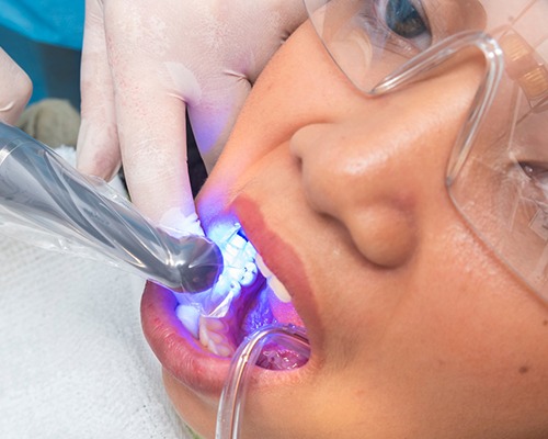 Curing light being used in young patient’s mouth