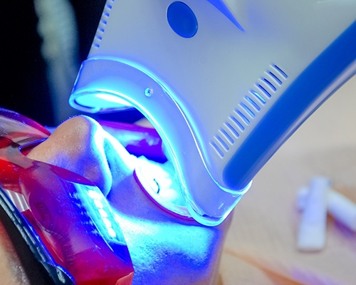 Close up of teeth whitening treatment